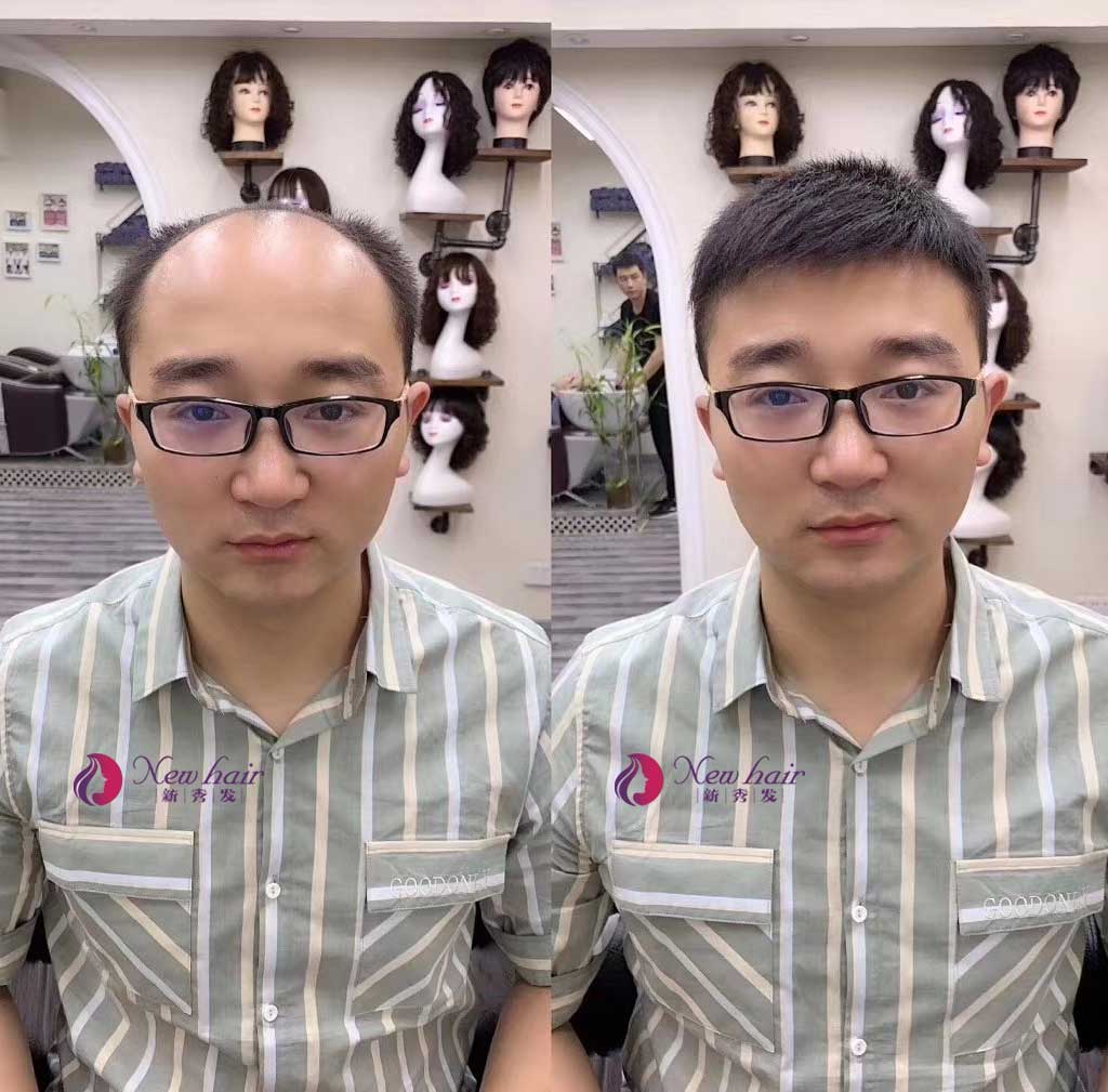 很多網(wǎng)友問我，為什么現(xiàn)在那么多人喜歡帶真發(fā)做的假發(fā)？