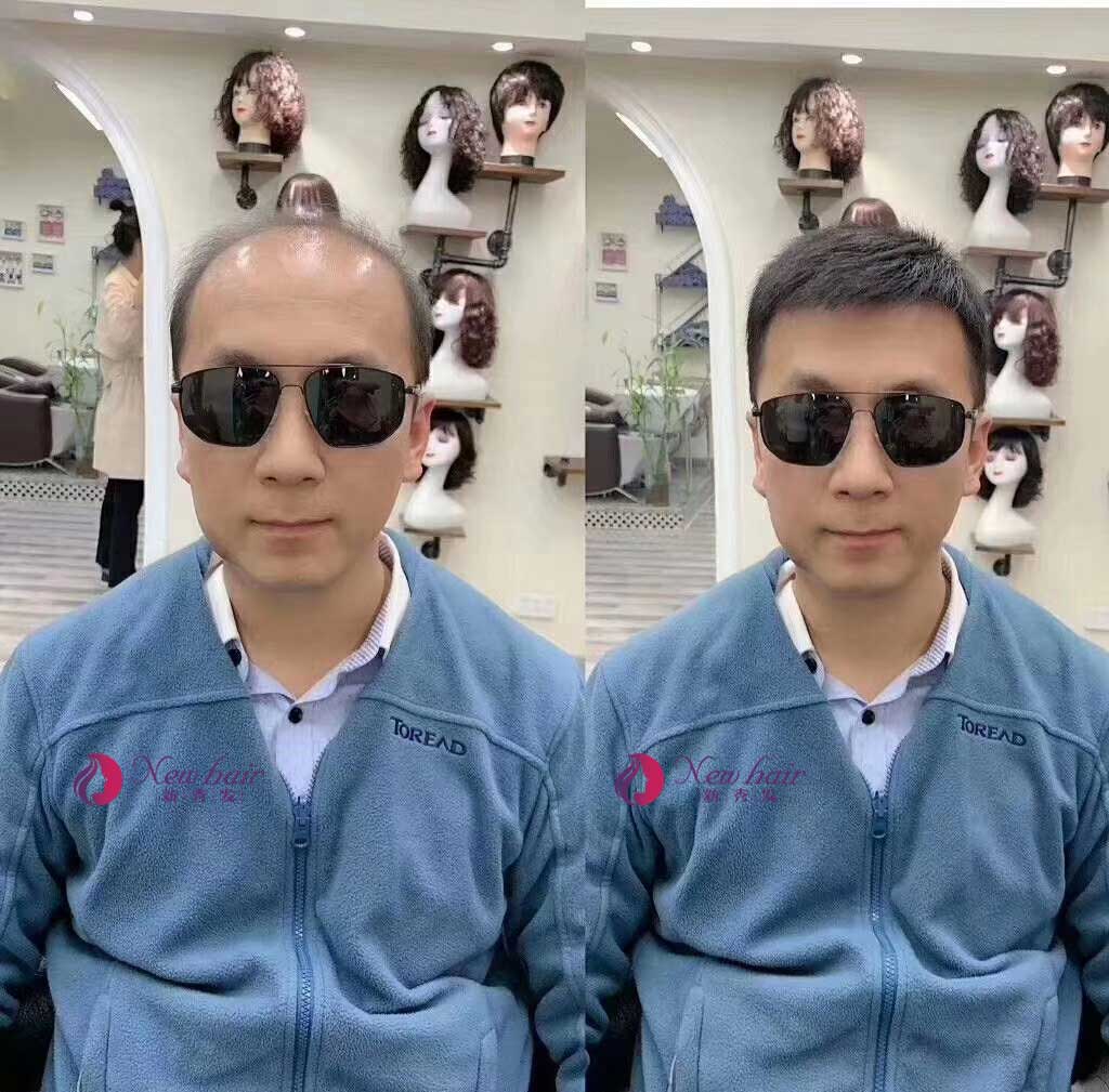 老年男士假發(fā)佩戴效果怎么樣？有沒有副作用？