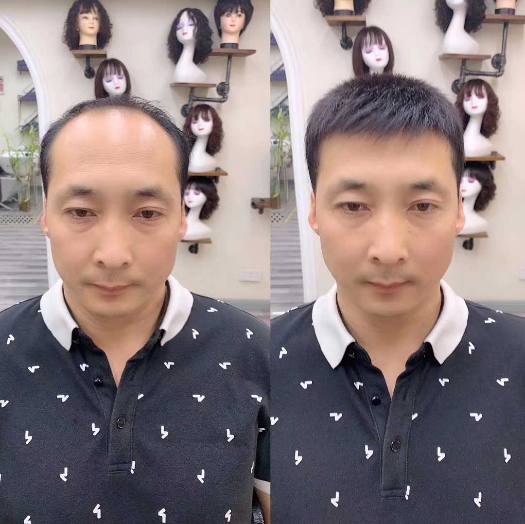 在青島這是脫發(fā)朋友真正需要的假發(fā)片！