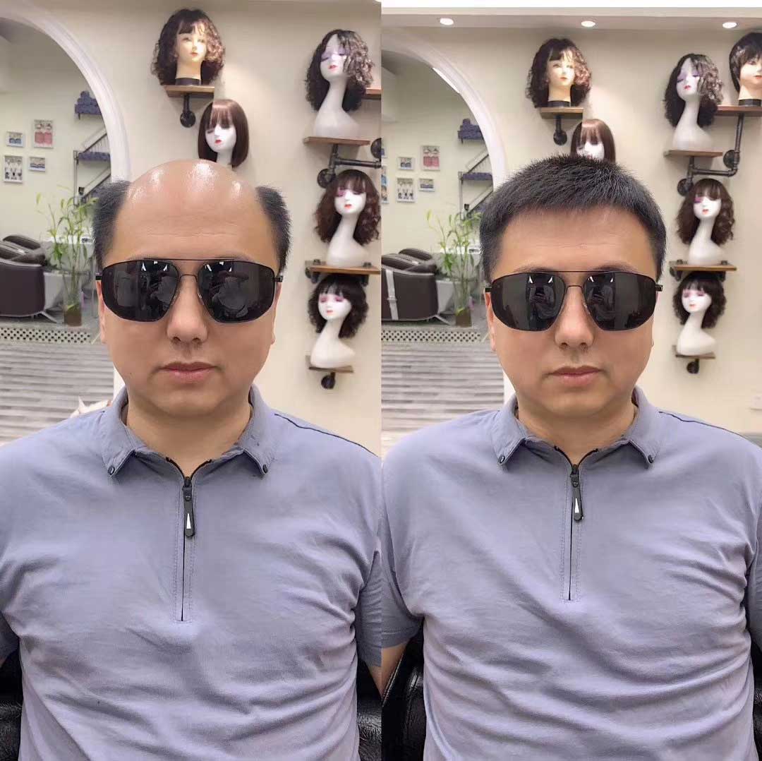 徹底解決掉發(fā)問題，這才是我要的！