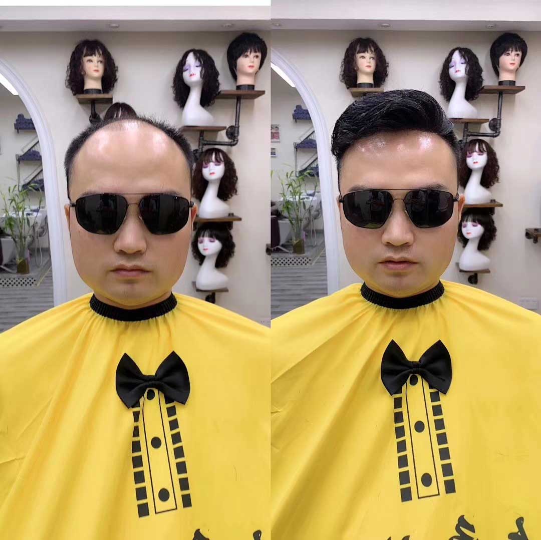 拯救禿頭造型，新秀發(fā)假發(fā)片立刻還你年輕自信人生！