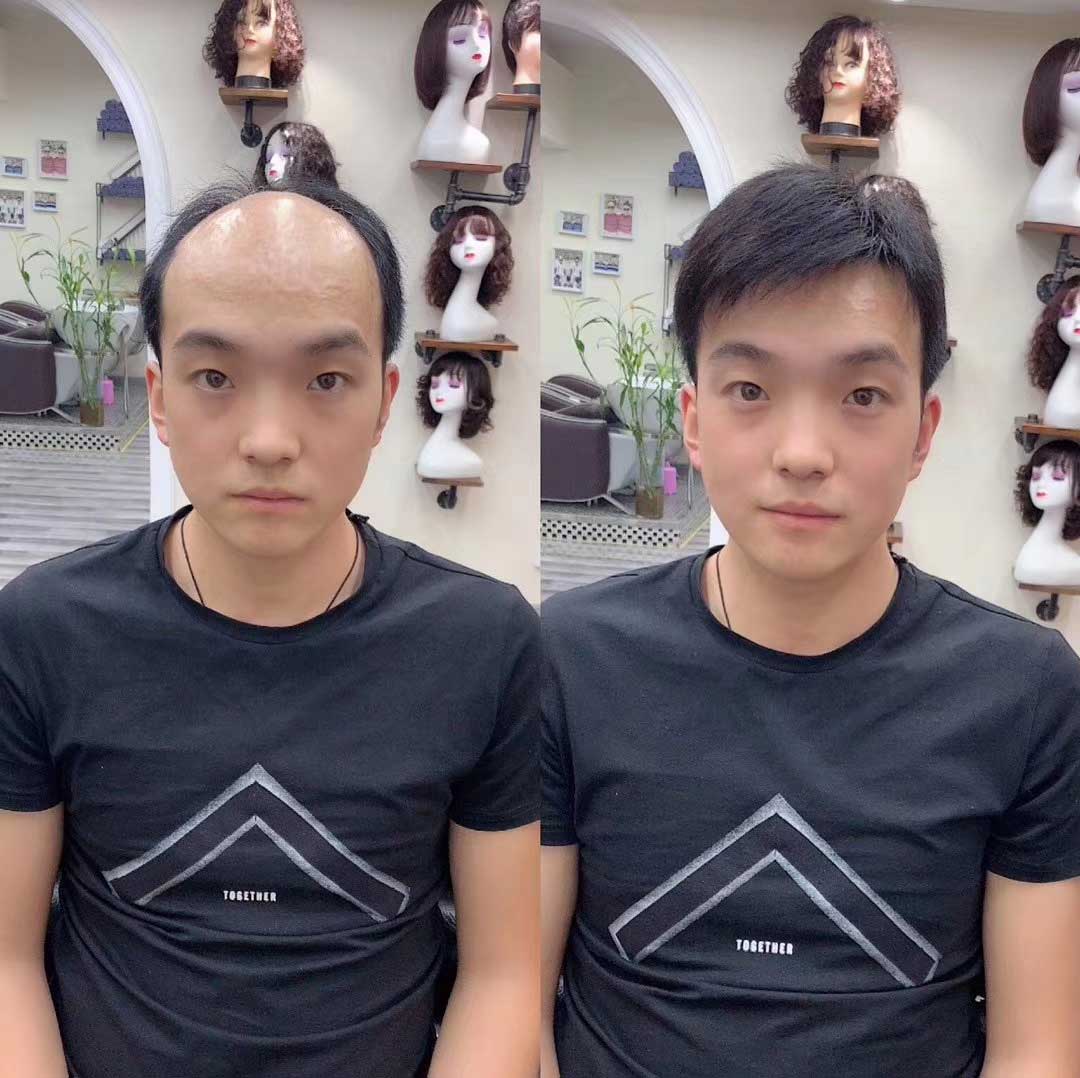 男人就該注重自己的形象，大叔通過假發(fā)片恢復(fù)發(fā)量變小鮮肉。